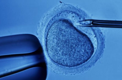 Как вести себя после переноса эмбриона? Экстракорпоральное оплодотворение. ХГЧ после переноса эмбриона